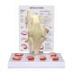 Model přetržení menisku kolenního kloubu